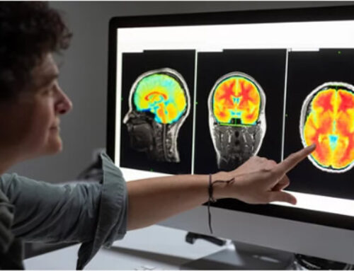 Estimulação Magnética Transcraniana (EMT)