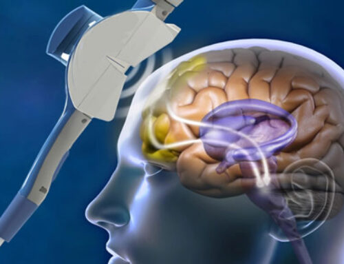 Eletroconvulsoterapia (ECT)